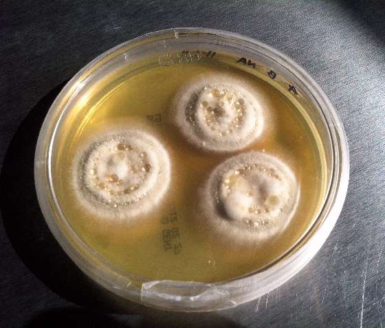Fungus growing in a Petri dish